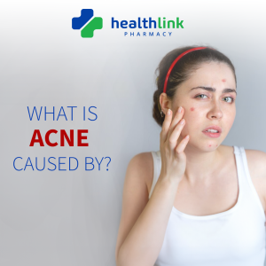 What is Acne Caused By