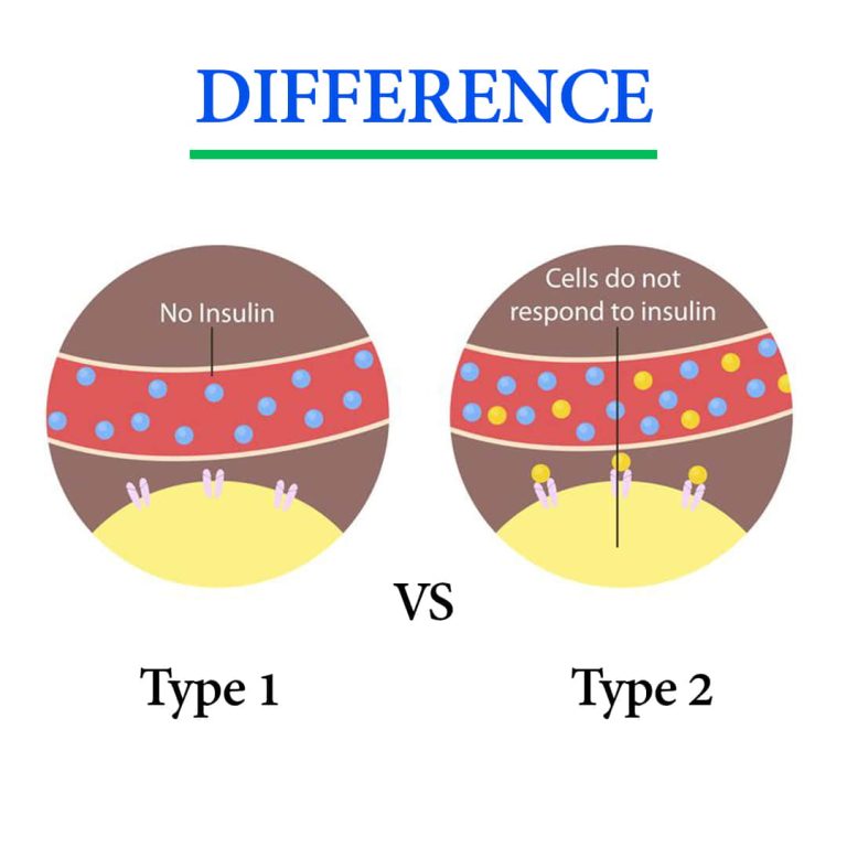 Type 1 vs Type 2 Diabetes