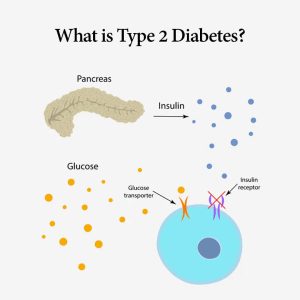 What is Type 2 Diabetes