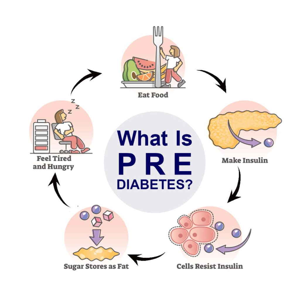 What is Pre Diabetes