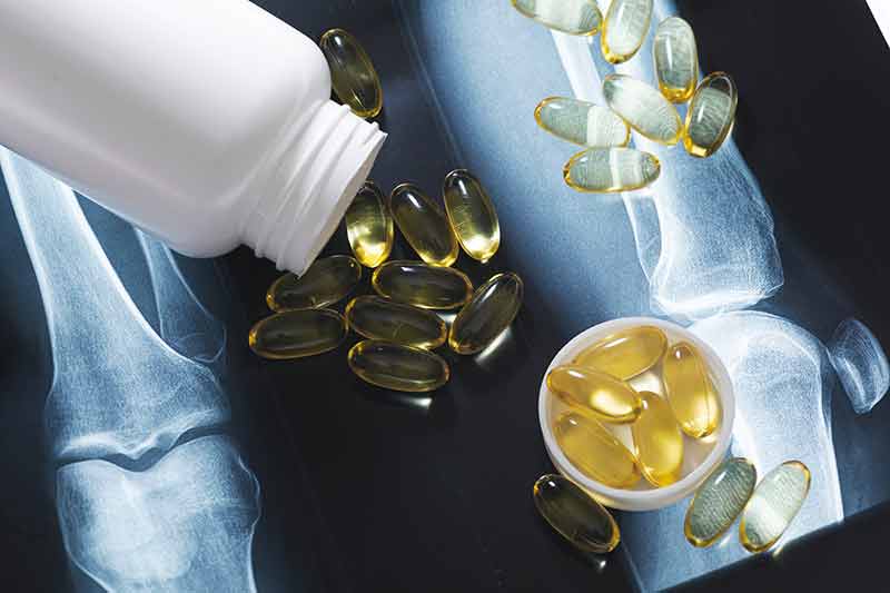 Health Supplements for Stronger, Healthier Bones