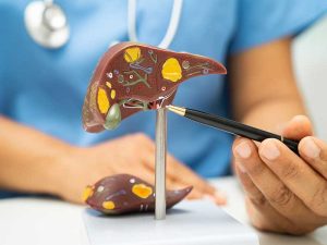 Liver Health and Detoxification: The Complete Guide to a Healthy Liver