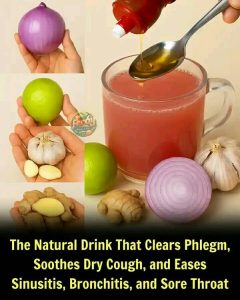 Health Risks of Excess Phlegm