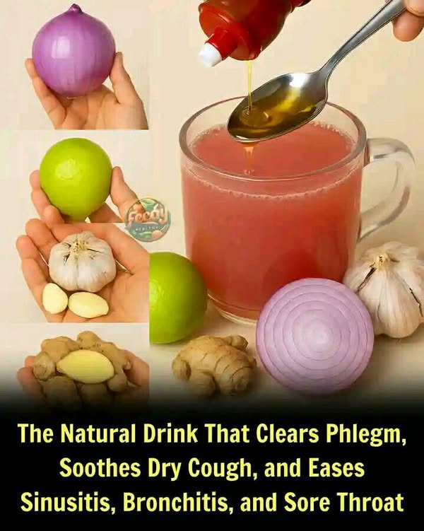 Health Risks of Excess Phlegm